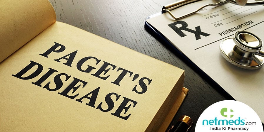 Paget's Disease Of Bone