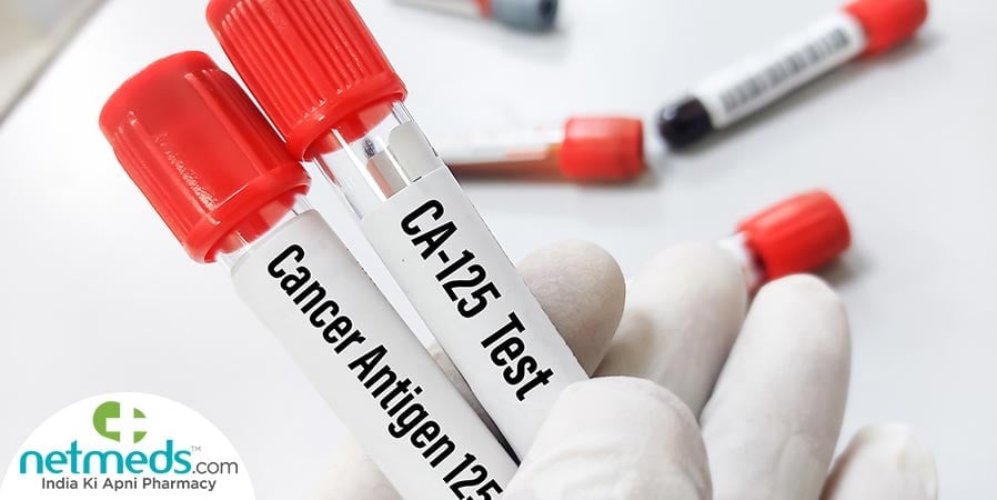 CA-125 Test - Cancer Antigen 125