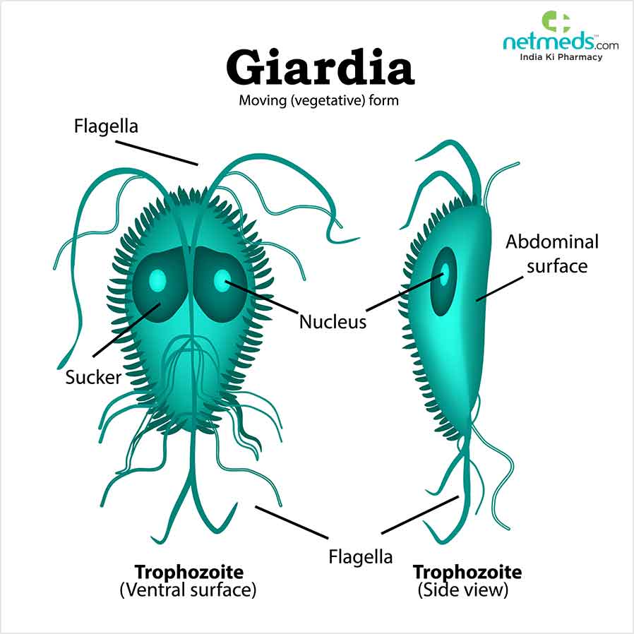 Giardiasis