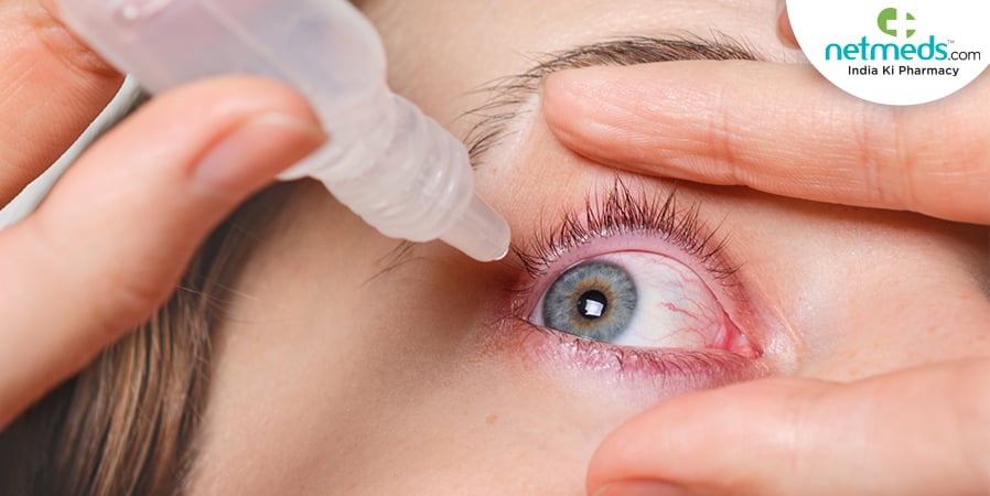 Eye infection