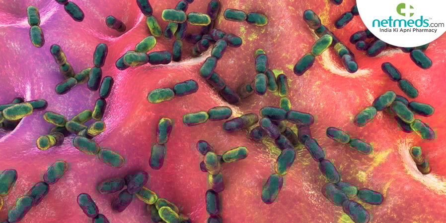 Peritonitis