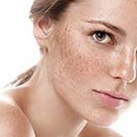 Hyperpigmentation Is Hormonal, Learn About Remedies