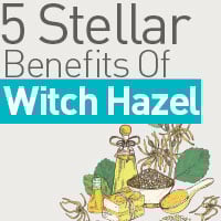 Witch Hazel: Know About The Spectacular Benefits Of This Magical Herb – Infographics