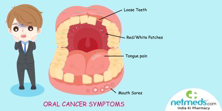Oral cancer symptoms