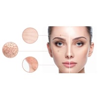 Why Does Your Skin Still Feel Dry Even After Moisturizing? Read Here