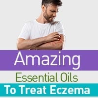 Eczema: 5 Incredible Essential Oils To Provide Relief From Itching - Infographic