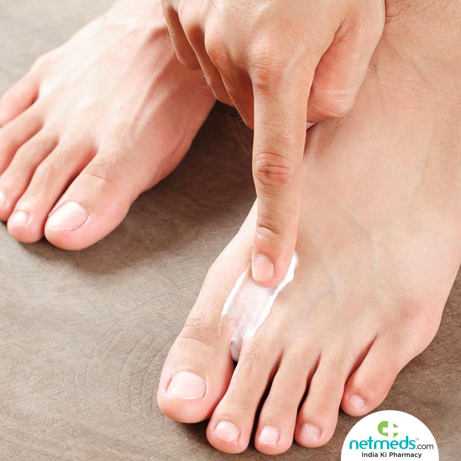 Applying Cream For Athlete's Foot Disease