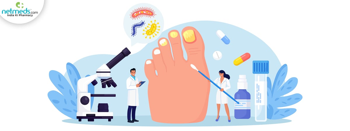toe nail fungal infection