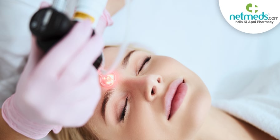 Laser Resurfacing
