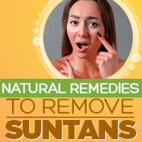 Got Tanned? Here’s Why It Can Harm Your Skin. 5 Ways To Detan Completely - Infographic