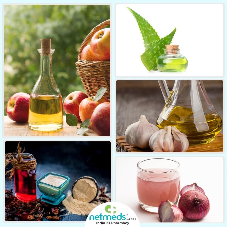 keloids home remedies