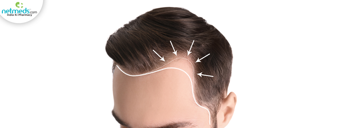 hair problem