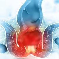 Arsha/Piles: Types, Ayurvedic Treatment Methods And Herbal Formulations To Treat This Painful Condition