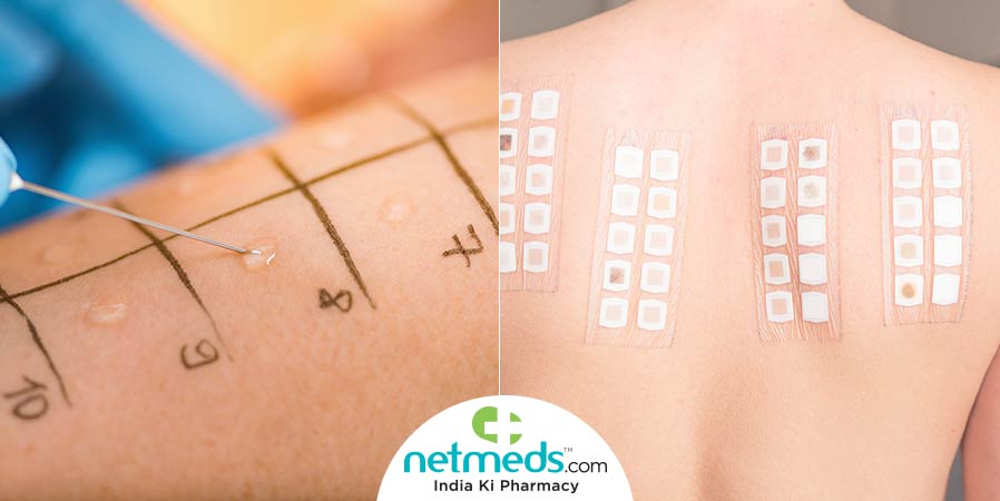 Allergy patch test