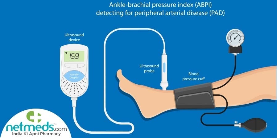 Doppler ultrasound