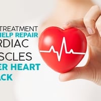 New Treatment May Help Repair Cardiac Muscles After Heart Attack