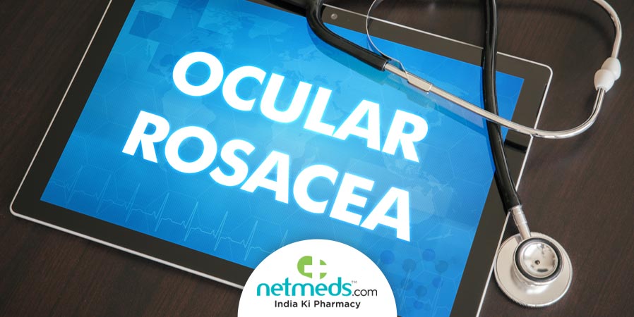 Ocular Rosacea