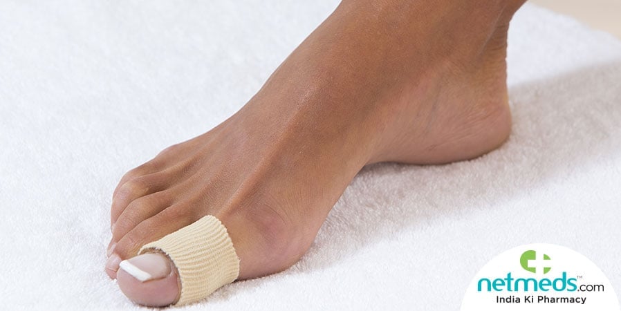 Home Remedies For Calluses And Corns