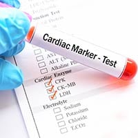Enzyme Marker Test: What Is It And What To Expect?