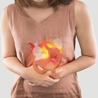 Hyperacidity/Acid Dyspepsia: Causes, Symptoms And Treatment