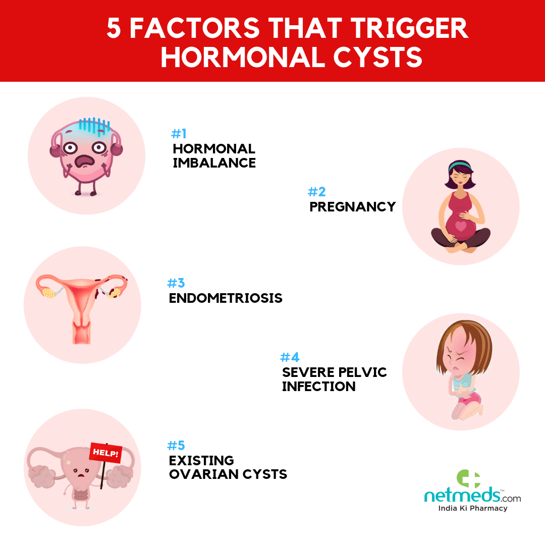 Causes, Symptoms And Treatment of Ovarian Cysts