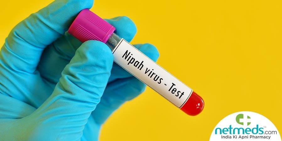 Nipah Virus Diagnosis