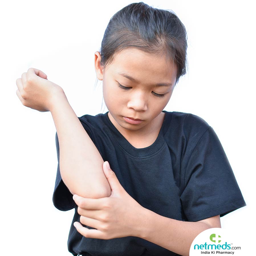 Scabies Is Highly Contagious