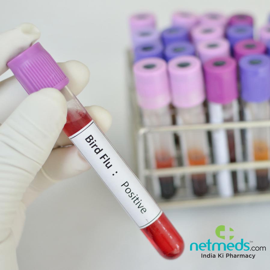 Test tube with bird flu positive