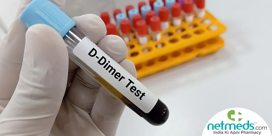 D-dimer test