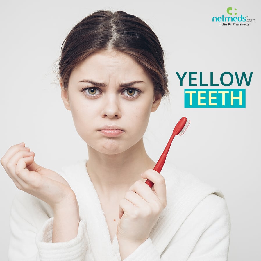Yellow teeth