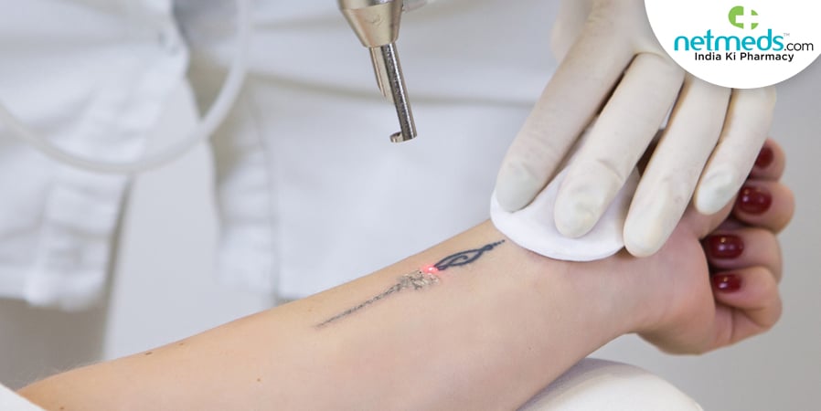 Getting Tattoo