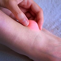 Desmoid Tumours: Causes, Symptoms And Treatment