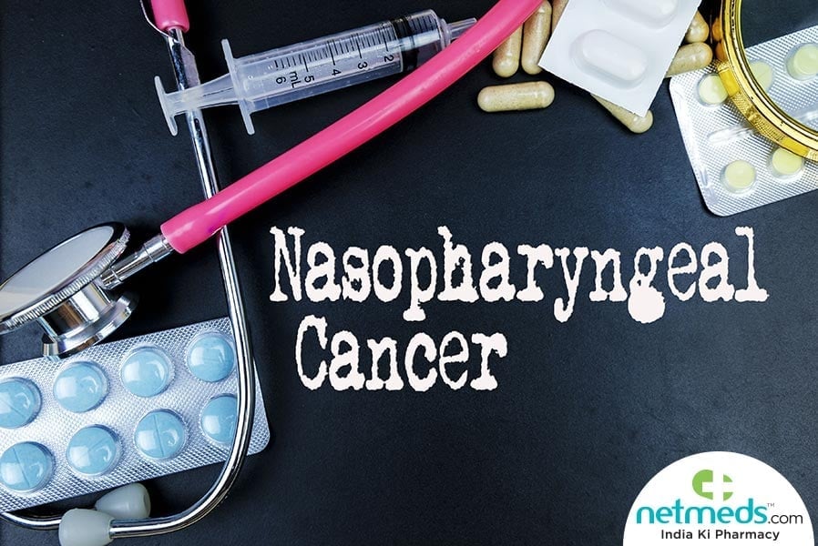 nasopharyngeal cancer
