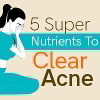 Anti-Acne Food: Eat Healthy To Heal Acne -Infographic