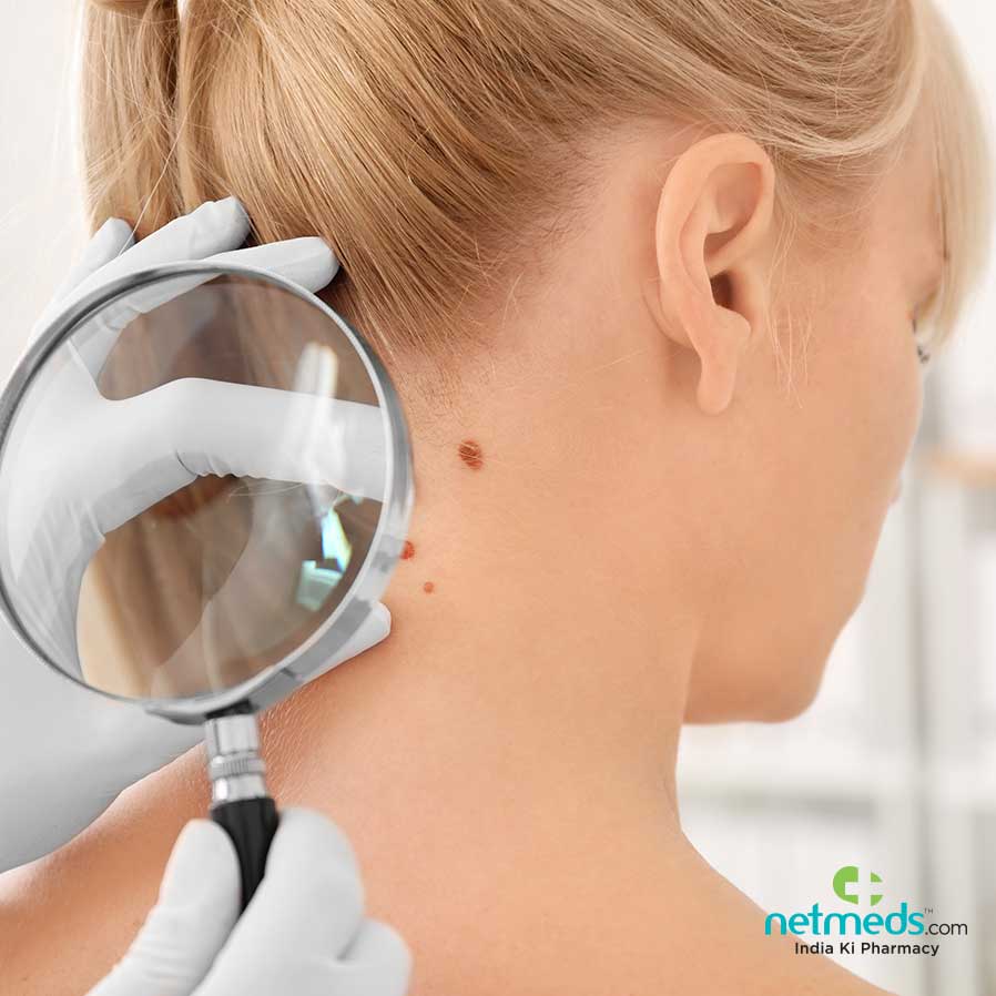 Skin Symptoms Prediabetic