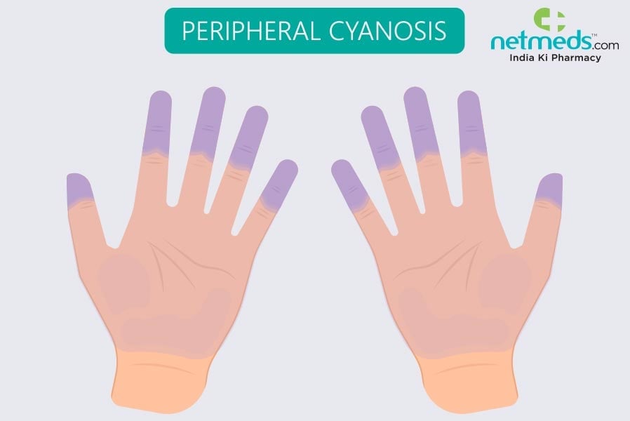 peripheral