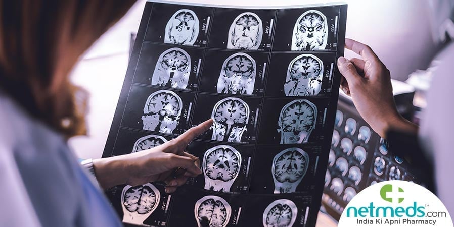 Brain atrophy