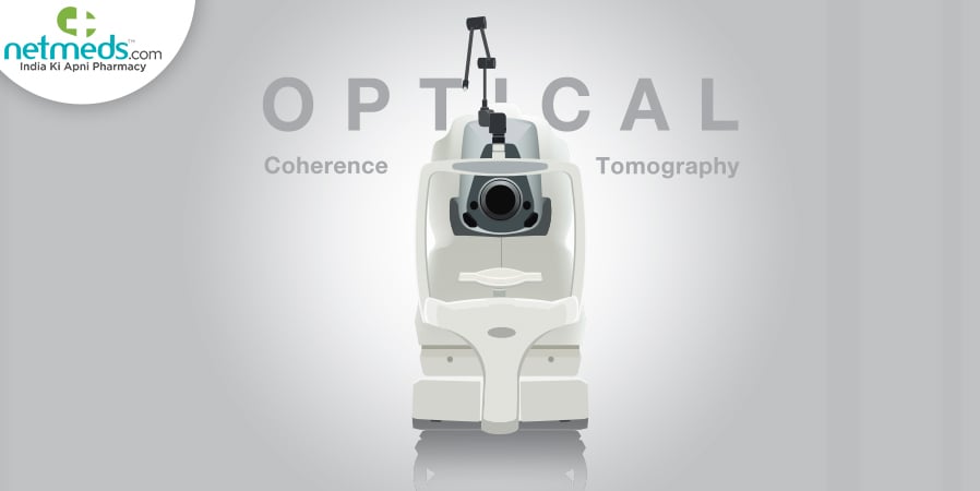 Optical coherence tomography