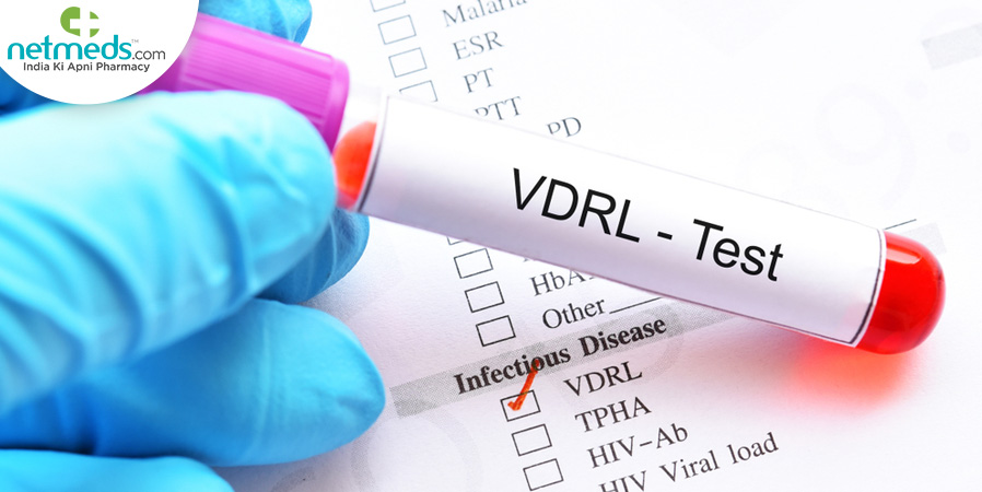 VDRL Test