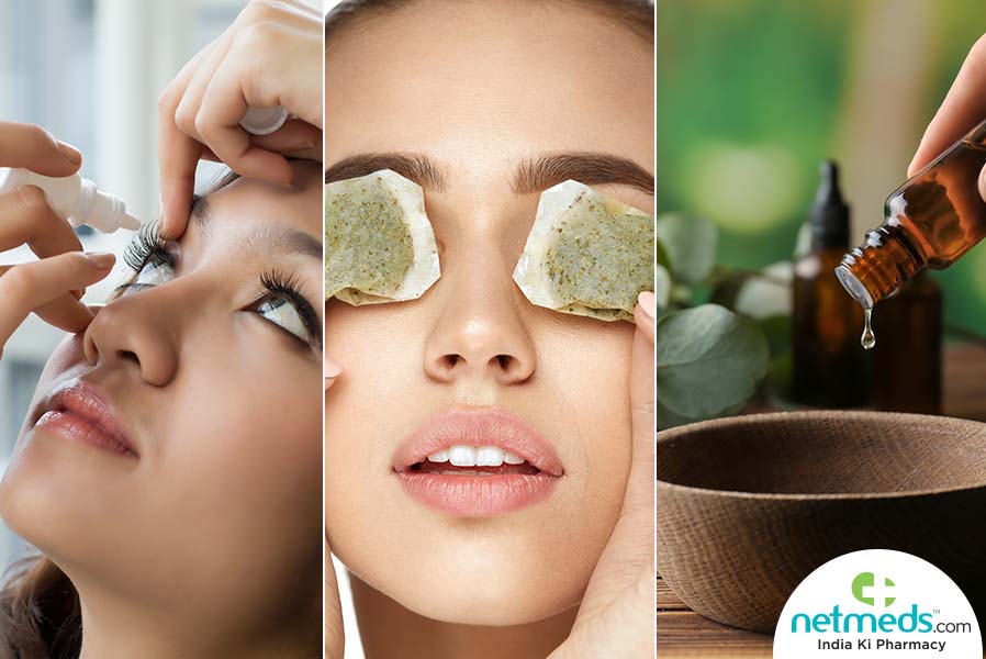 home remedies for eye infections