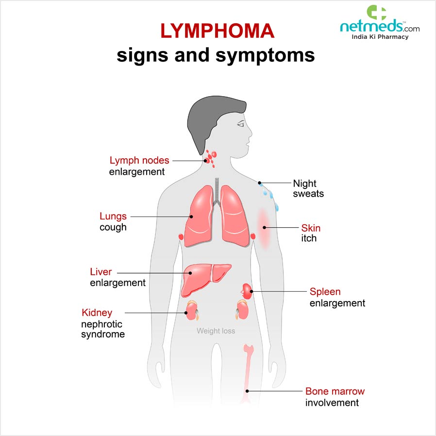 Lymphoma
