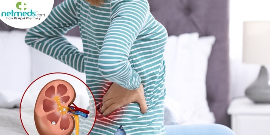 Woman with kidney stone