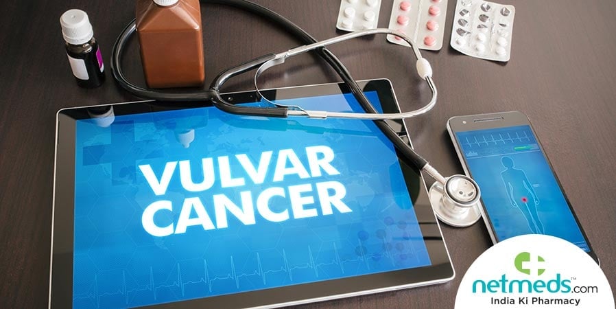 Causes, Symptoms And Treatment Of Vulvar Cancer