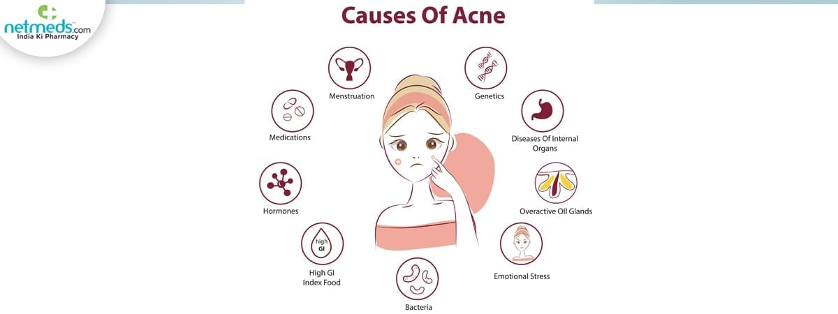 acne causes