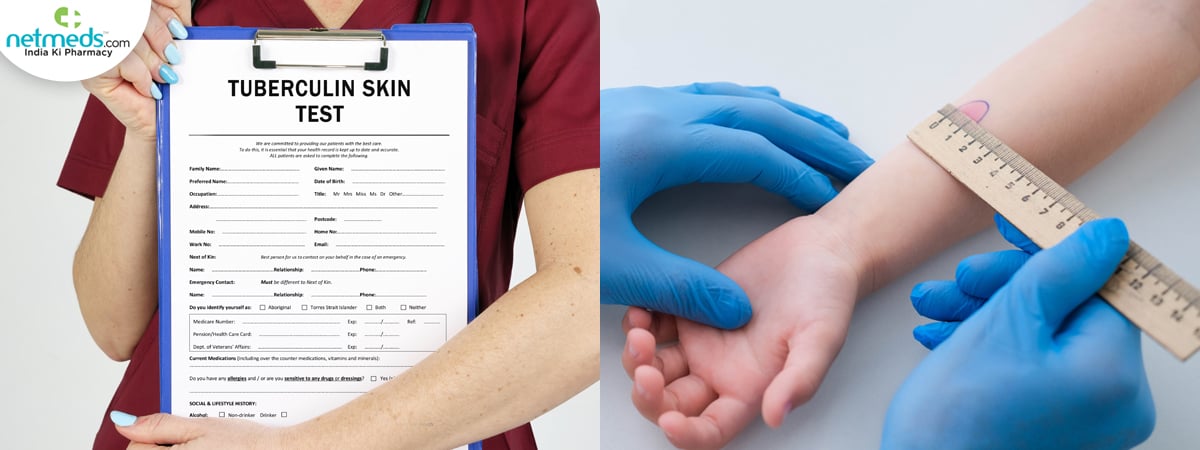 tb test