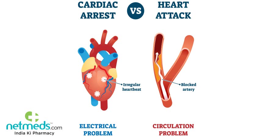 Cardiac arrest vs heart attack