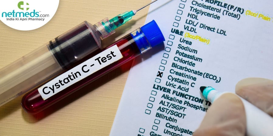 Cystatin C - Test