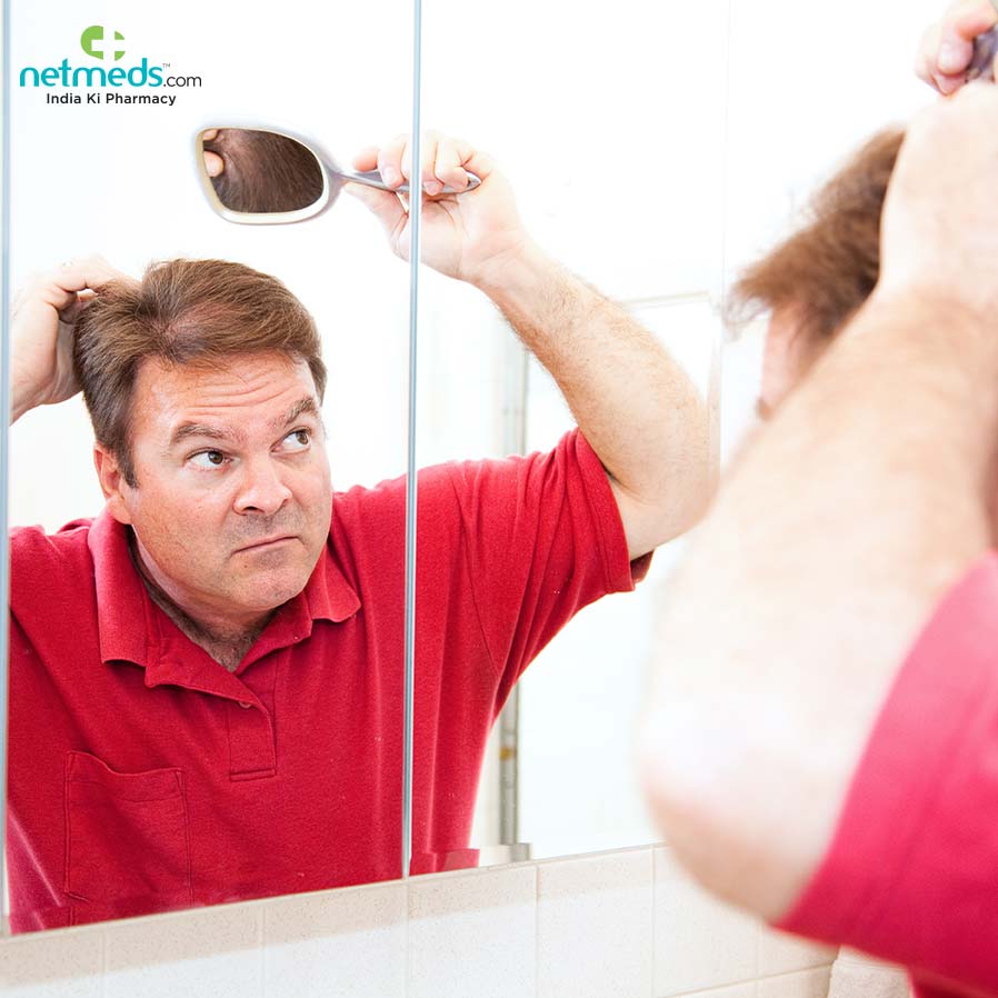 Man checking his  hair losing in patches