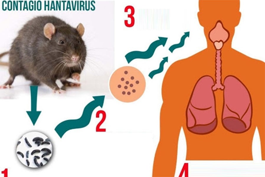 Hantavirus