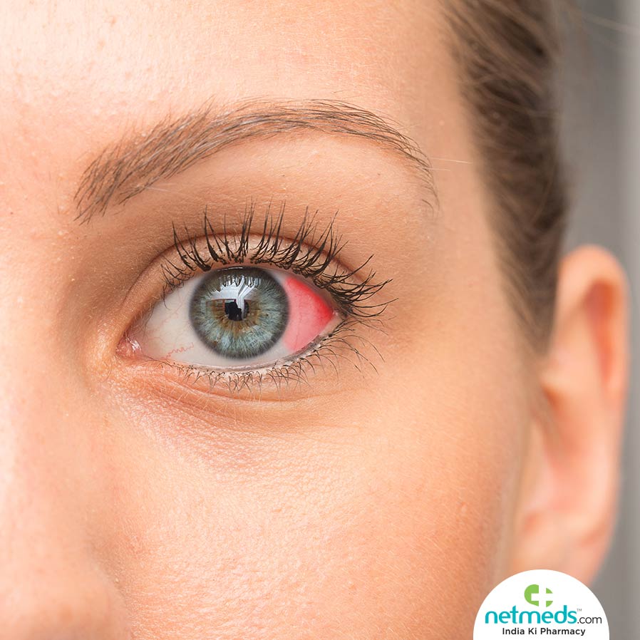 Red spot on eye
